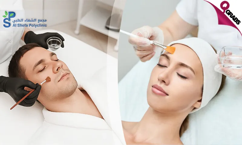 Instant Glow: Chemical Peel for Ladies & Men at Al Shefa Polyclinic!